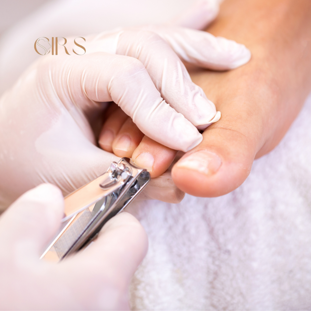 Unhas – Cirs, Vila Olivo, Valinhos - SP – foto 3